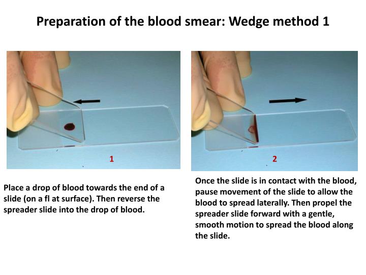 PPT - Aim : To make a blood smear and to count the different types of ...