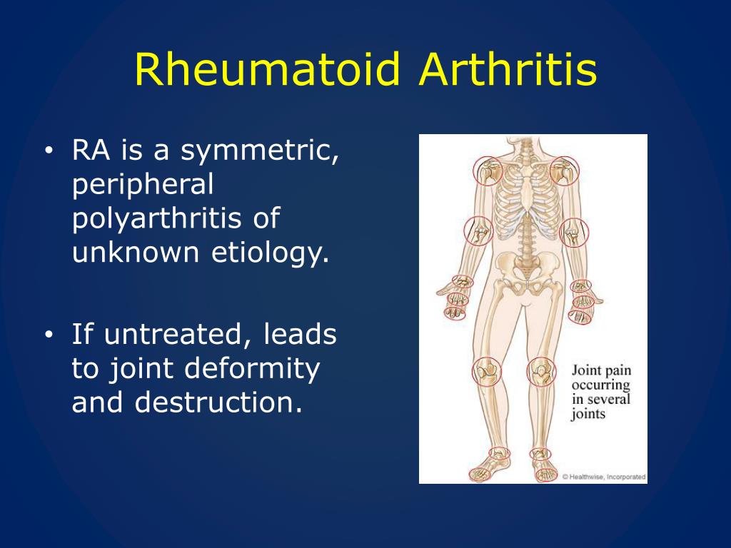 the clinical presentation of rheumatoid arthritis