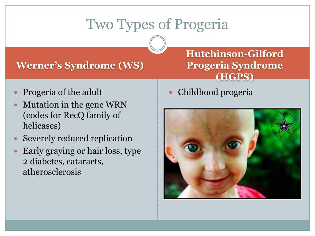 PPT Progeria PowerPoint Presentation, free download ID2137589 PPT Progeria PowerPoint Presentation, free download ID2137589