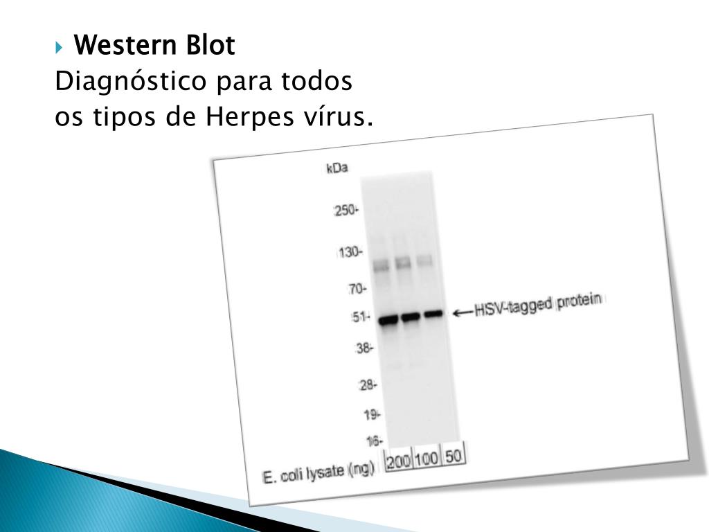 western blot test for herpes western blot test for herpes