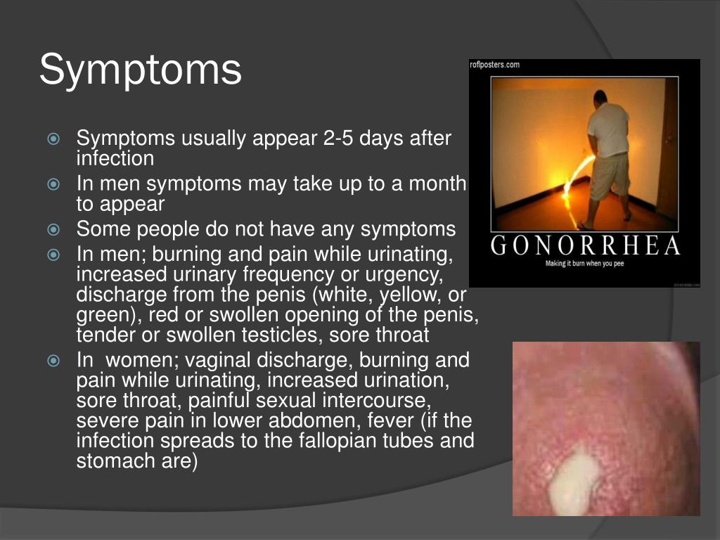 gonorrhea symptoms in females