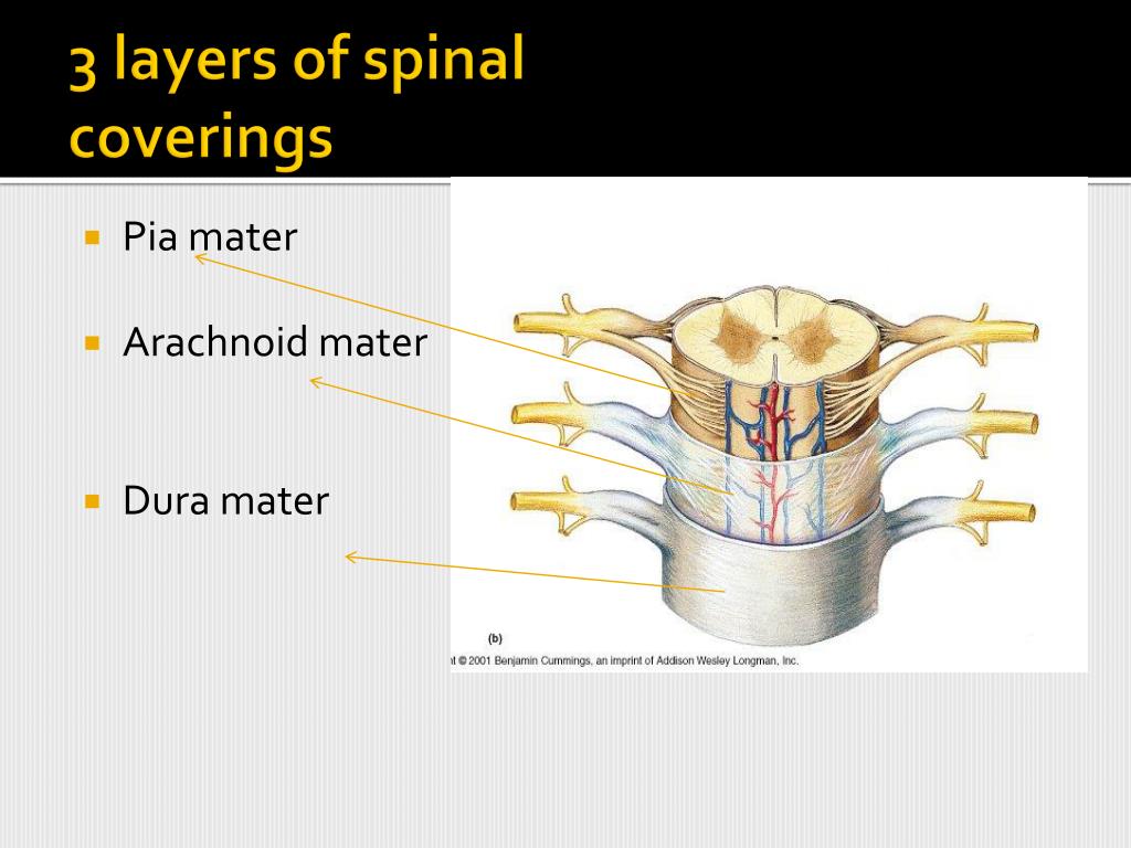 PPT - Spinal Cord Compression PowerPoint Presentation, free download