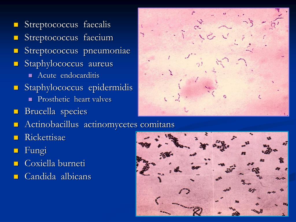 Streptococcus в мазке у мужчин. Коксиелла Бернета микробиология. Стрептококк фекалис. Стафилококки стрептококки пневмококки.