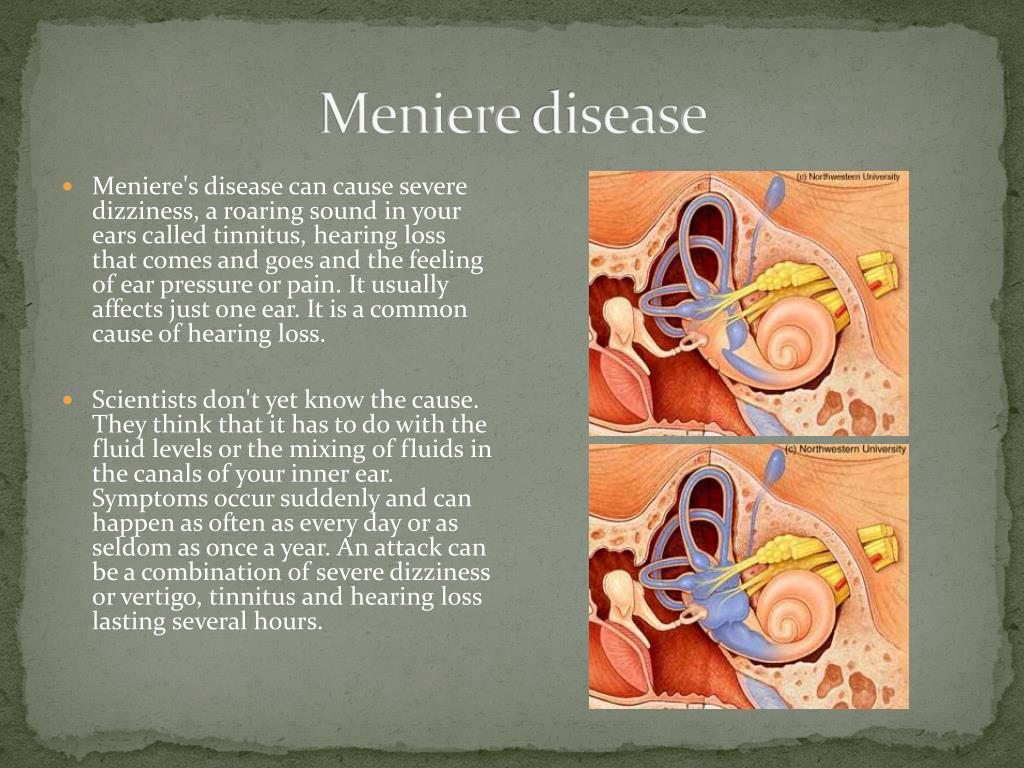 PPT Eye Signs, Symptoms, and Diseases PowerPoint Presentation, free