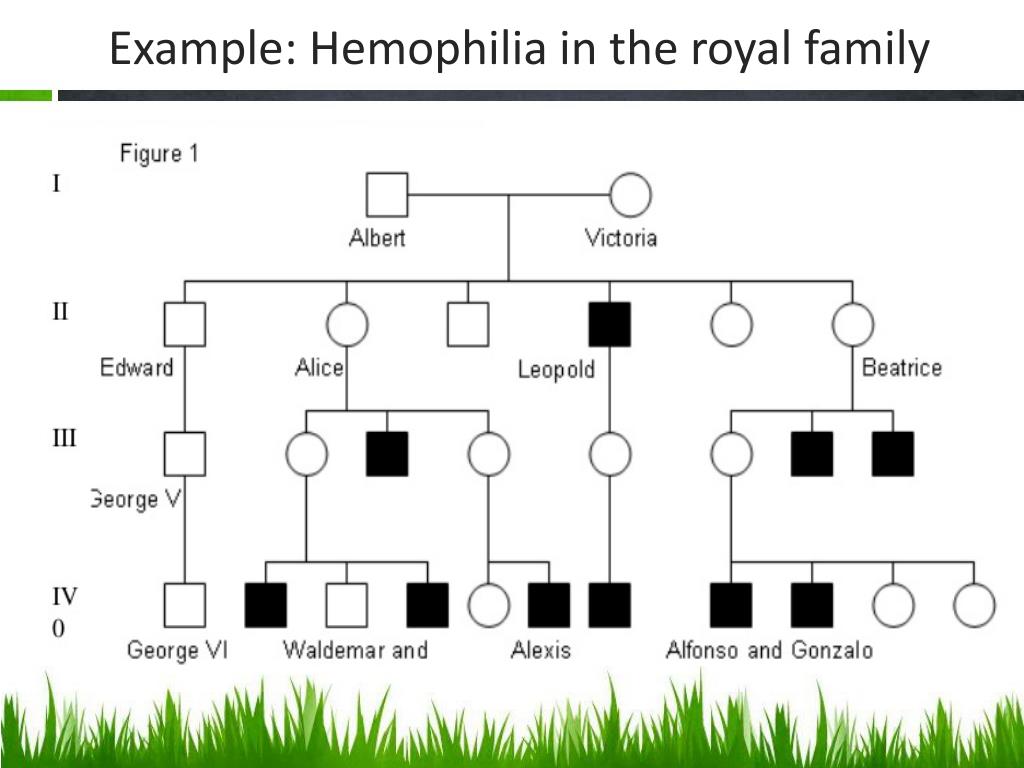 Polydactyly Pedigree Chart