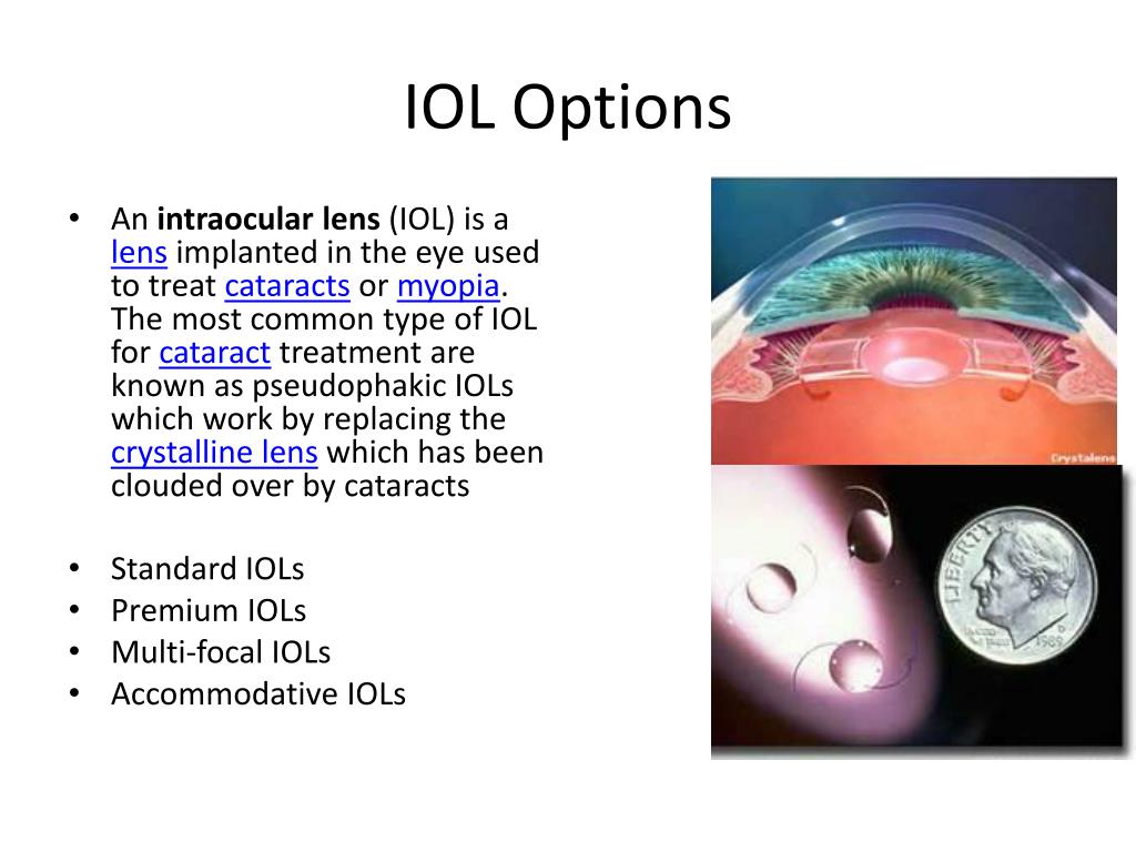 PPT Cataract Surgery & Premium IOLs PowerPoint Presentation, free