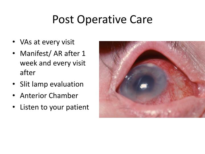 PPT Cataract Surgery & Premium IOLs PowerPoint Presentation ID2155016