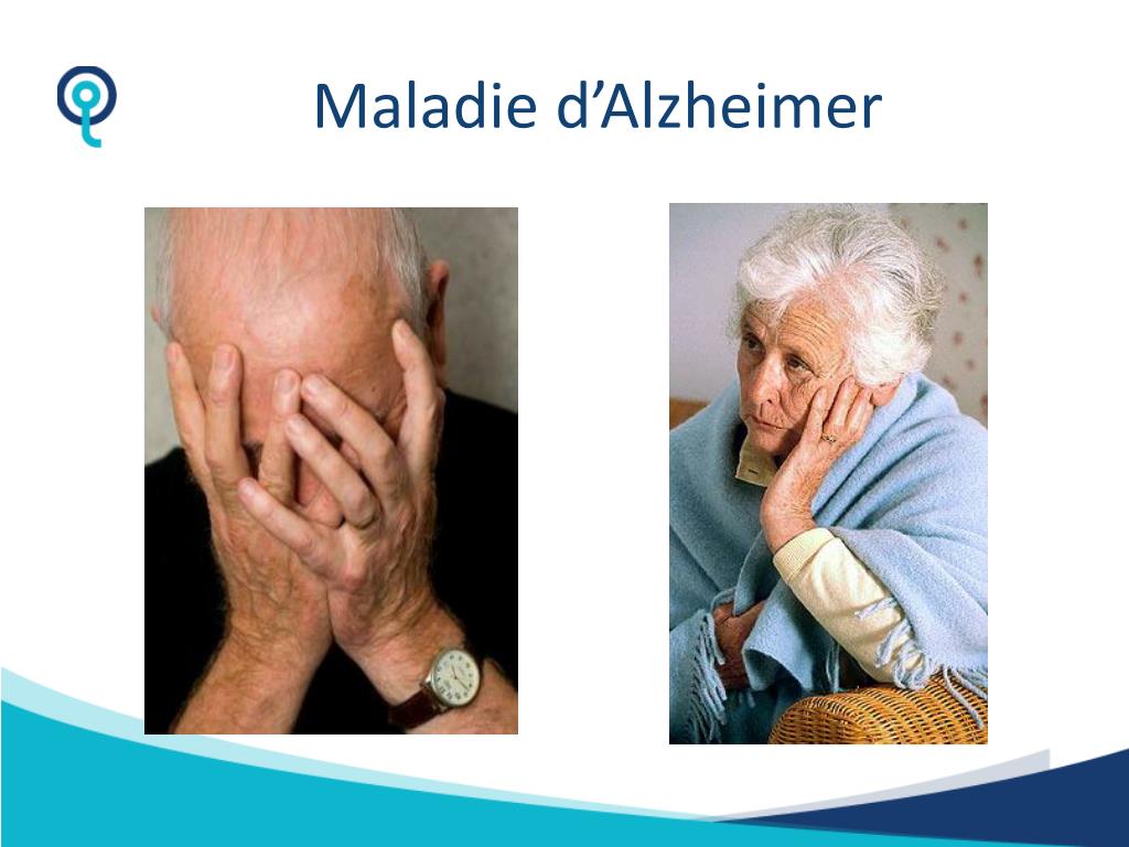 Comment Se Manifeste La Maladie D Alzheimer – NVGQON