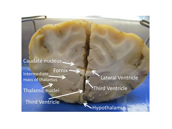 PPT - Lab 12 Sheep Brain Dissection PowerPoint Presentation - ID:2162022