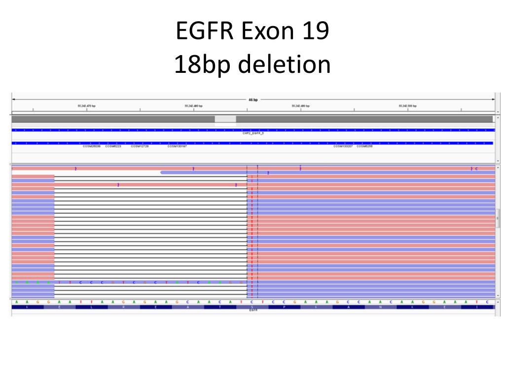 PPT - Clinical Genotyping of Lung Cancer in the Era of Personalized