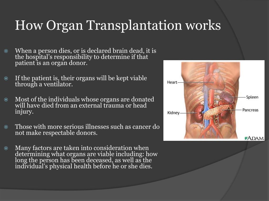 thesis statement for organ transplant