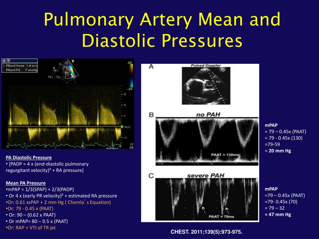 PPT Role Of The Echocardiogram In The Assessment Of Pulmonary ppt-role-of-the-echocardiogram-in-the-assessment-of-pulmonary