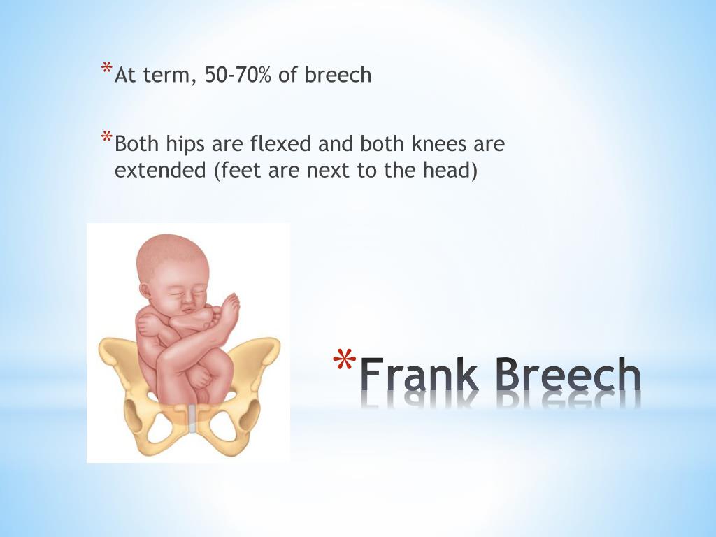 frank breech presentation in english