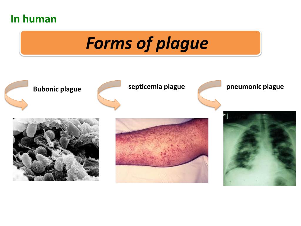Disease Infected: Plague download the new for android Disease Infected: Plague download the new for android