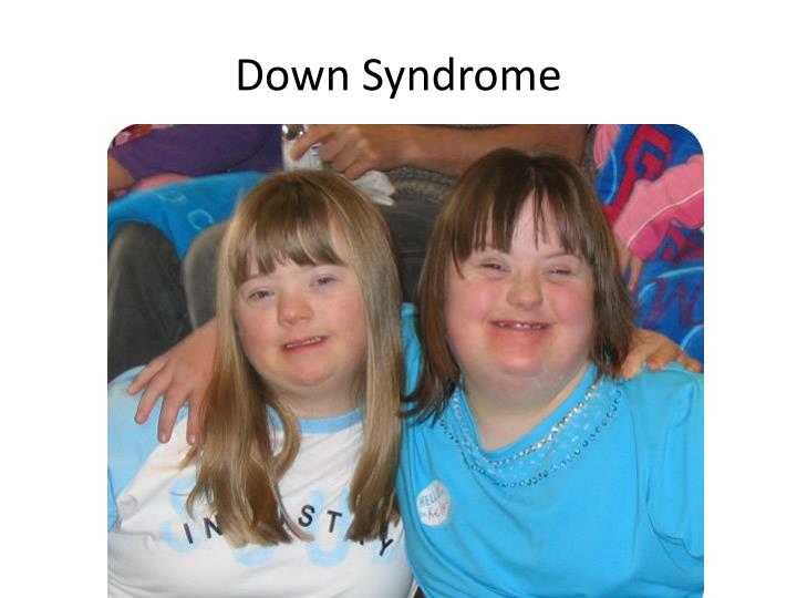 PPT Down Syndrome ( trisomy 21) PowerPoint Presentation ID2170957