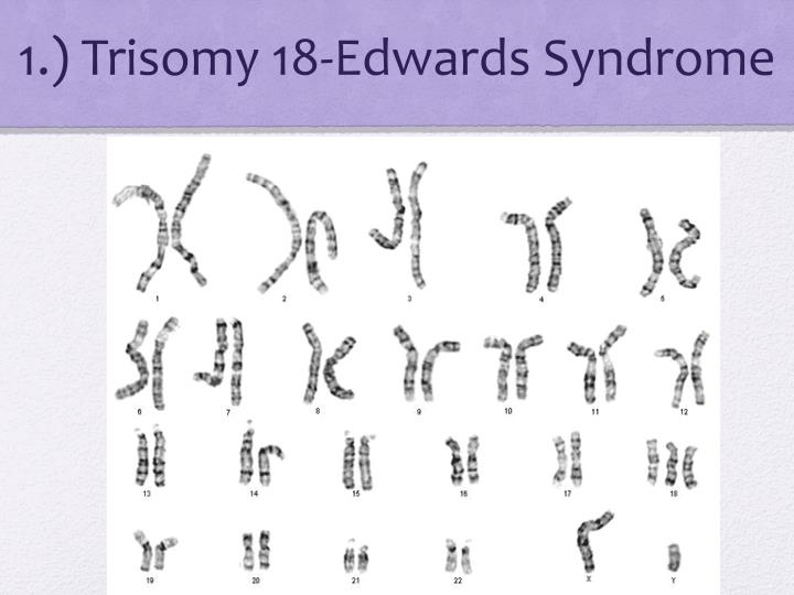 PPT - KARYOTYPE AND GENETIC DISORDERS PowerPoint Presentation - ID:2170996