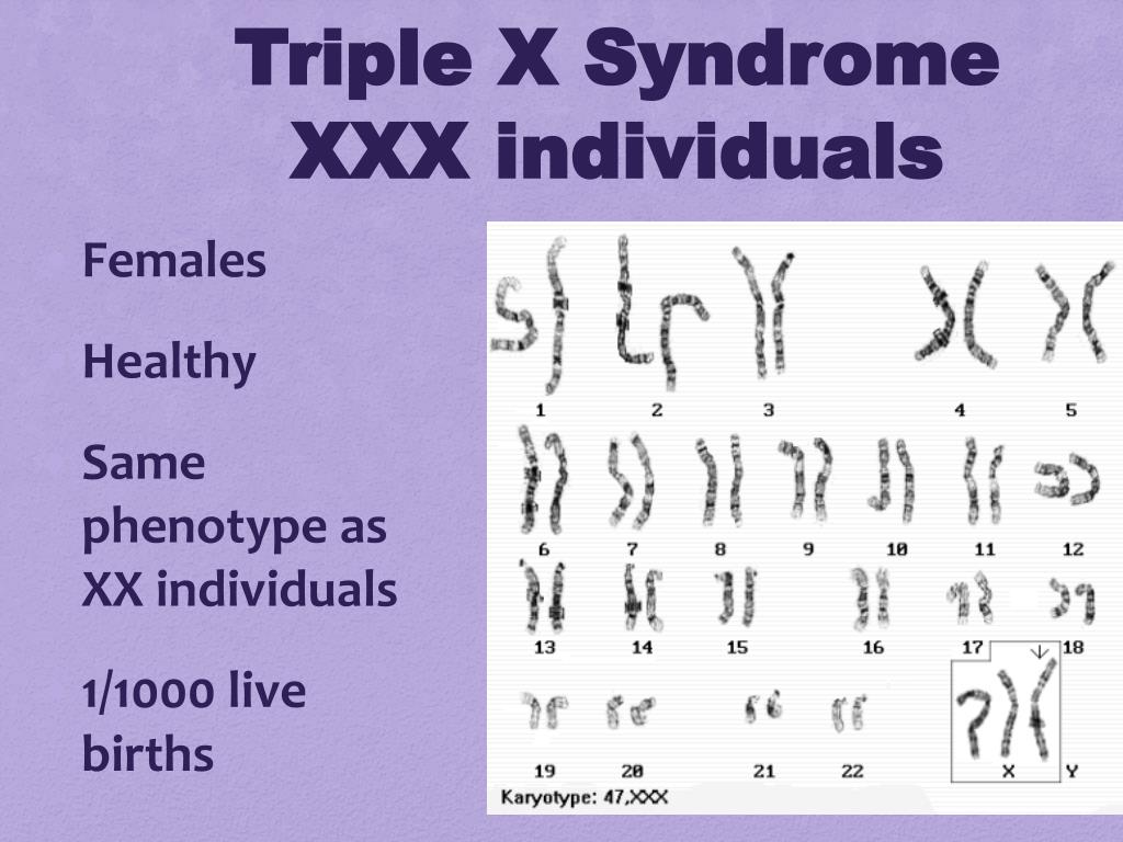 Ppt Karyotype And Genetic Disorders Powerpoint Presentation Free