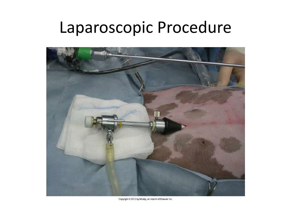 laparoscopic converted to open icd 10