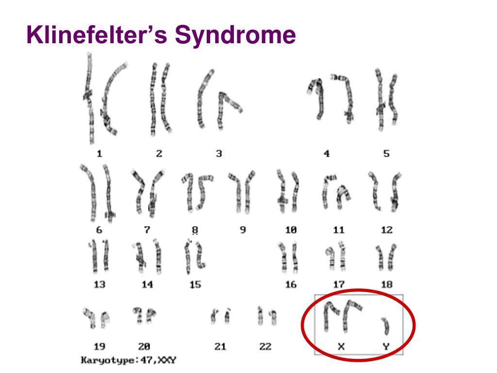 Ppt Chromosomal Abnormalities In Humans Powerpoint Presentation Free