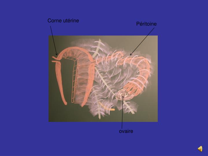 PPT Trompe utérine PowerPoint Presentation ID2173008