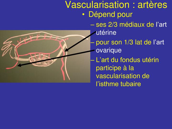 PPT Trompe utérine PowerPoint Presentation ID2173008