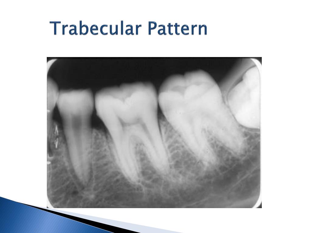 PPT EO 005.06 Normal Intraoral Radiographic Anatomy PowerPoint