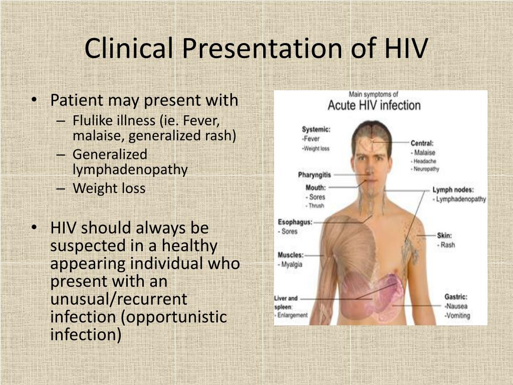 hiv presentation conclusion