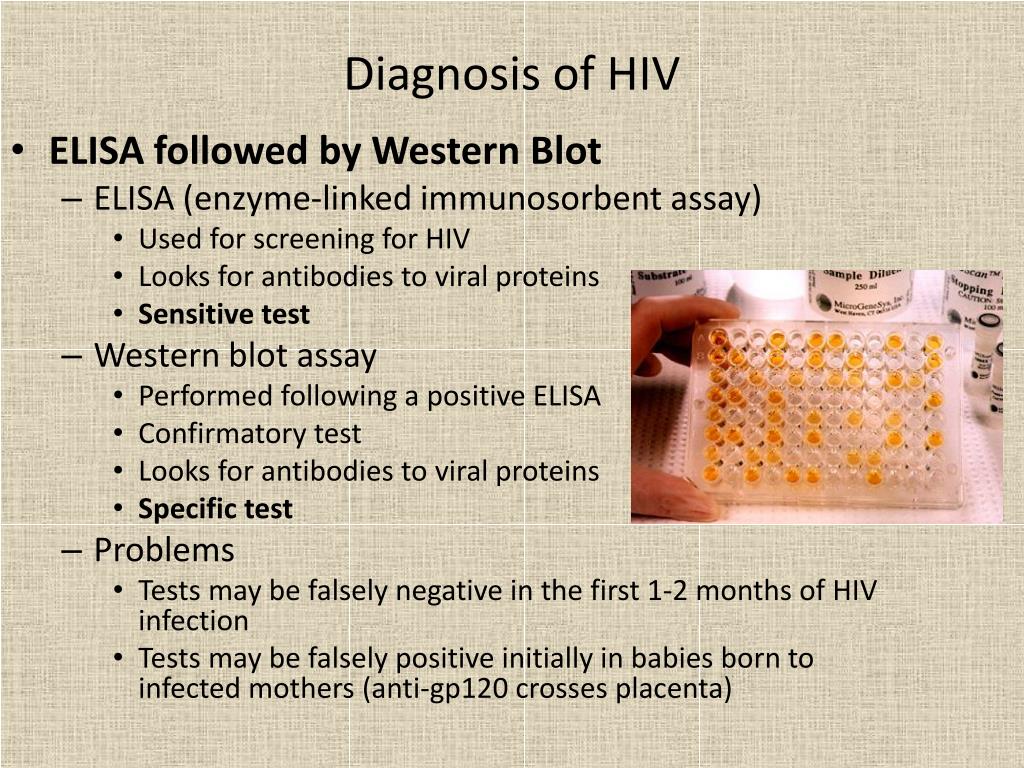 clinical presentation of hiv