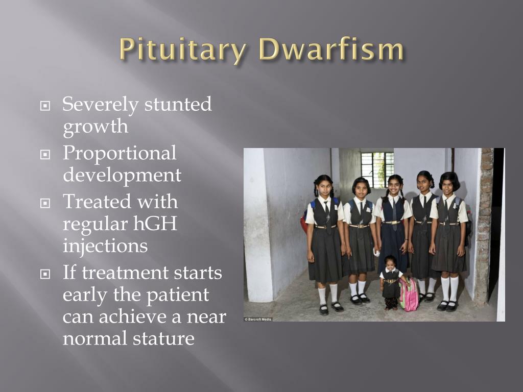 Ppt Problems Associated With The Pituitary Gland Powerpoint