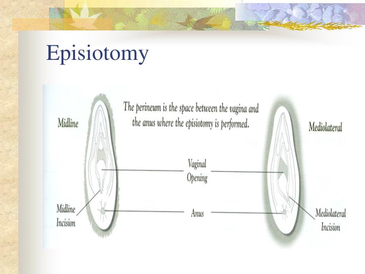 PPT Second Stage Labor Management PowerPoint Presentation ID2181562