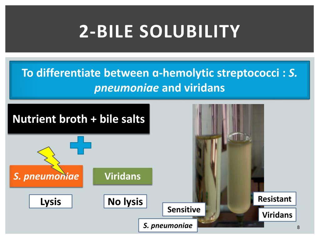 bile solubility test bile solubility test