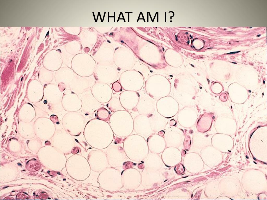 Липоциты. Белая жировая ткань адипоциты. Подкожная жировая клетчатка гистология. Адипоциты гистология. Адипоциты гистология препарат.