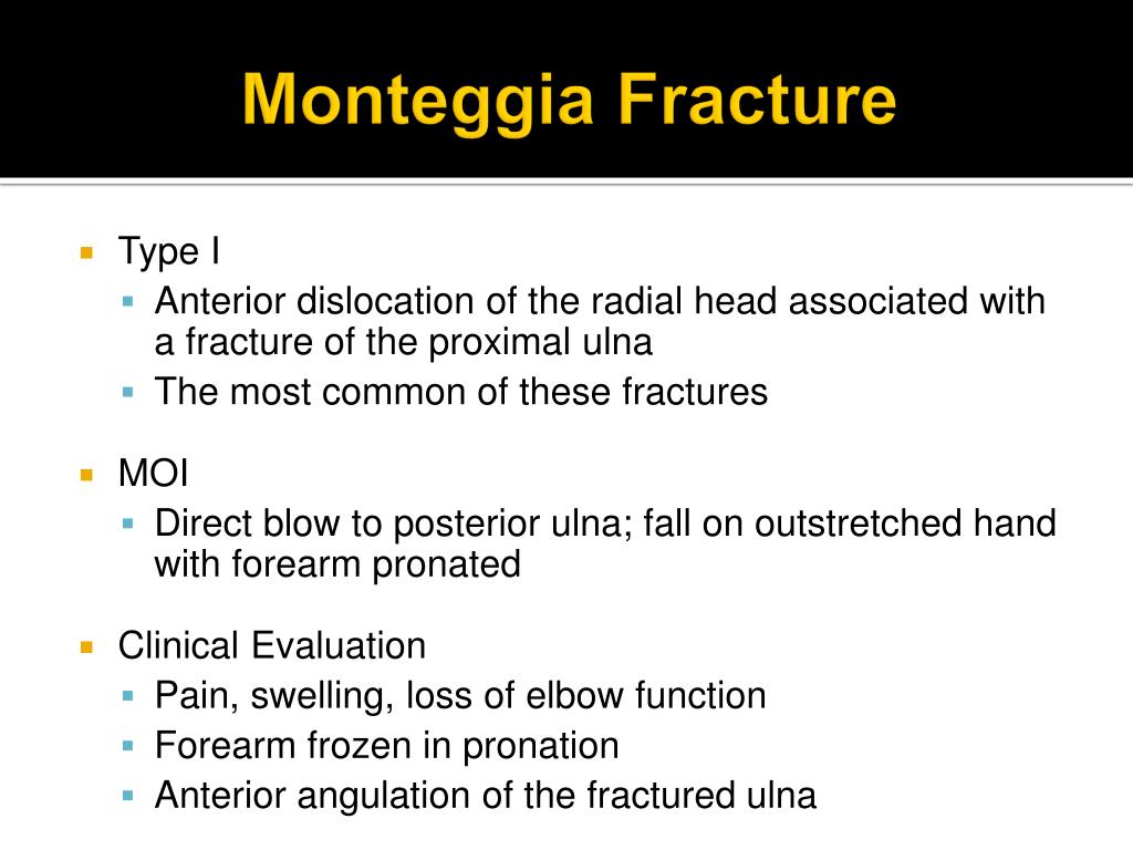 etiology of monteggia fracture