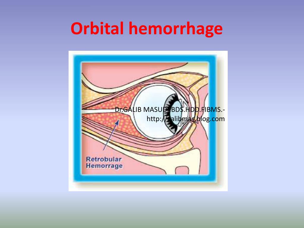 PPT Nasal And Nasal Complex Fractures Primary Management PowerPoint PPT Nasal And Nasal Complex Fractures Primary Management PowerPoint