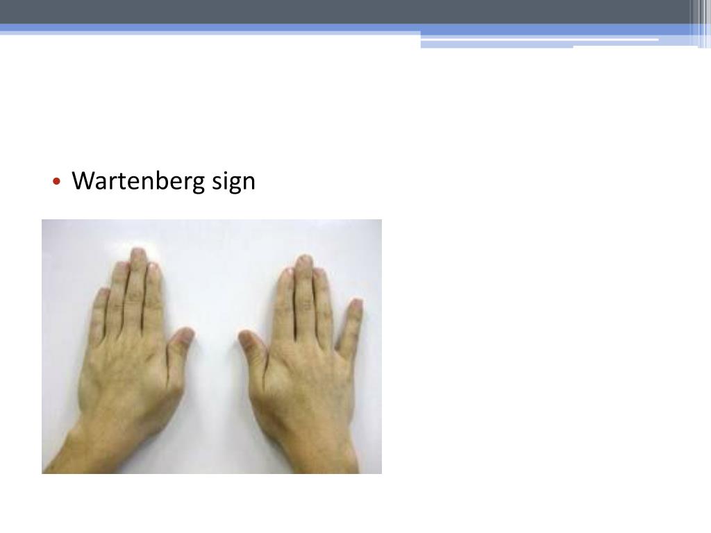 PPT Nerve Compression Syndromes PowerPoint Presentation Free PPT Nerve Compression Syndromes PowerPoint Presentation Free