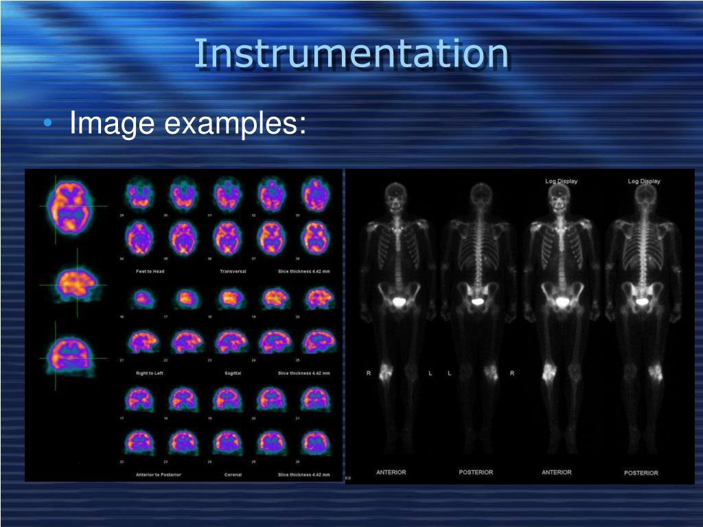 PPT - BASIC PHYSICS & RADIOPHARMACY & INSTRUMENTATION in NUCLEAR ...