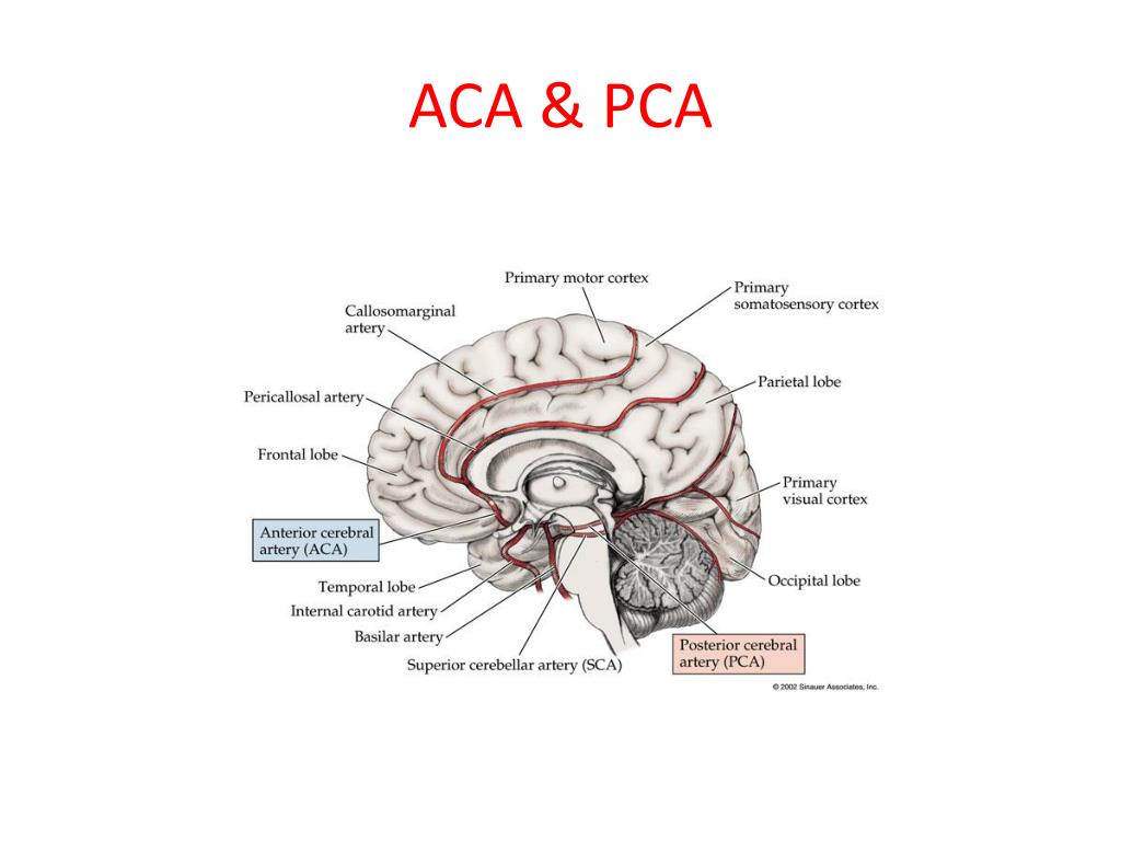 PPT - CEREBROVASCULAR DISEASES for medical students PowerPoint ...