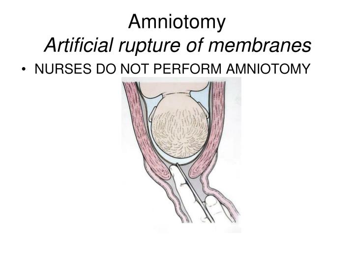 PPT - Cervical Ripening and Induction/Augmentation of Labor PowerPoint ...