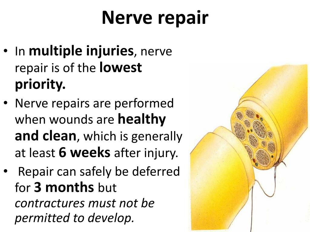 Can nerve damage be repaired?
