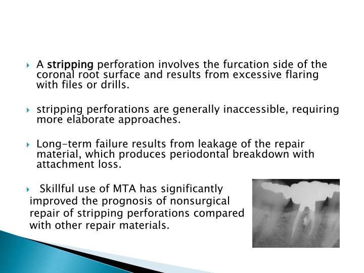 PPT Procedural Accidents ( Endodontics Mishaps ) PowerPoint