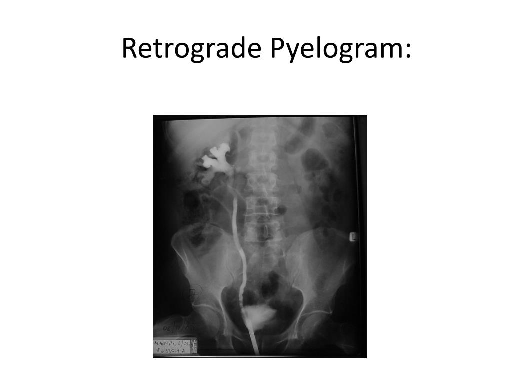 PPT Treatment PowerPoint Presentation, free download ID2240516