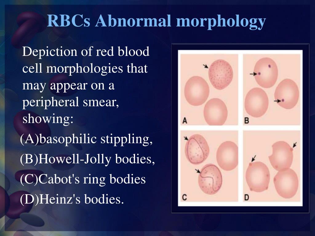 PPT - RBCs Abnormal morphology PowerPoint Presentation, free download -  ID:369630