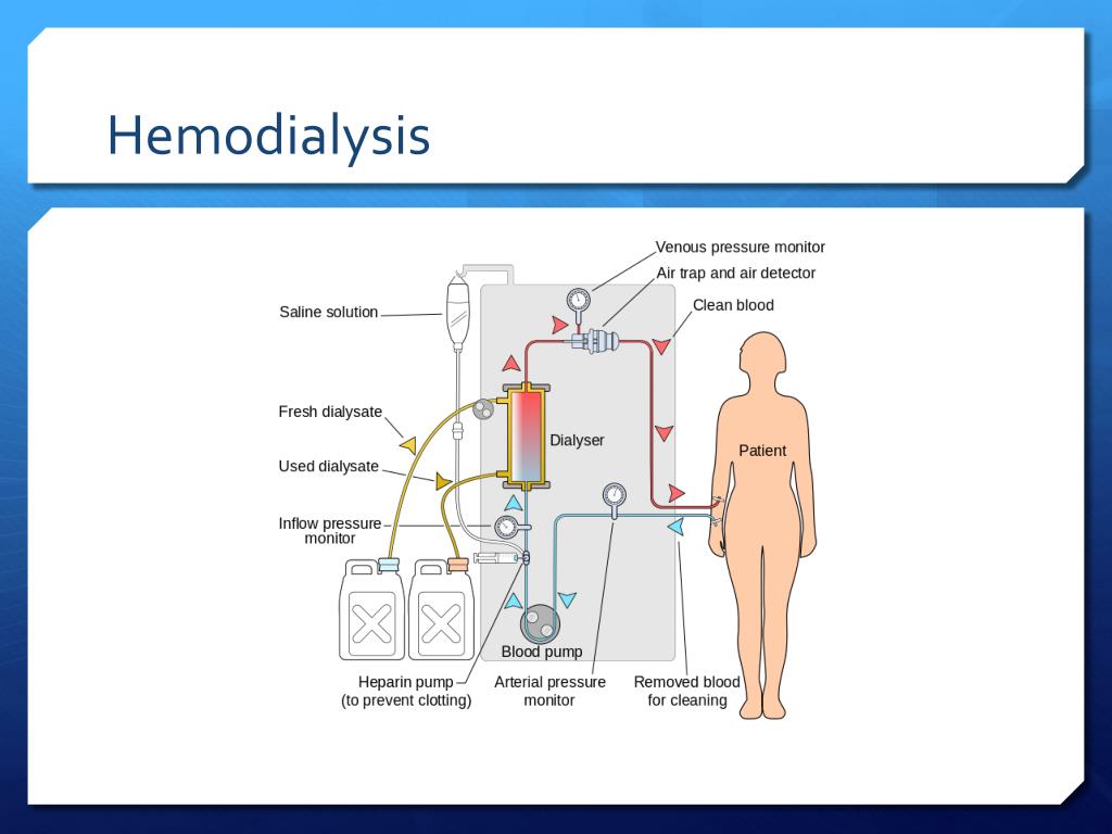 ppt-renal-failure-and-complications-of-hemodialysis-powerpoint