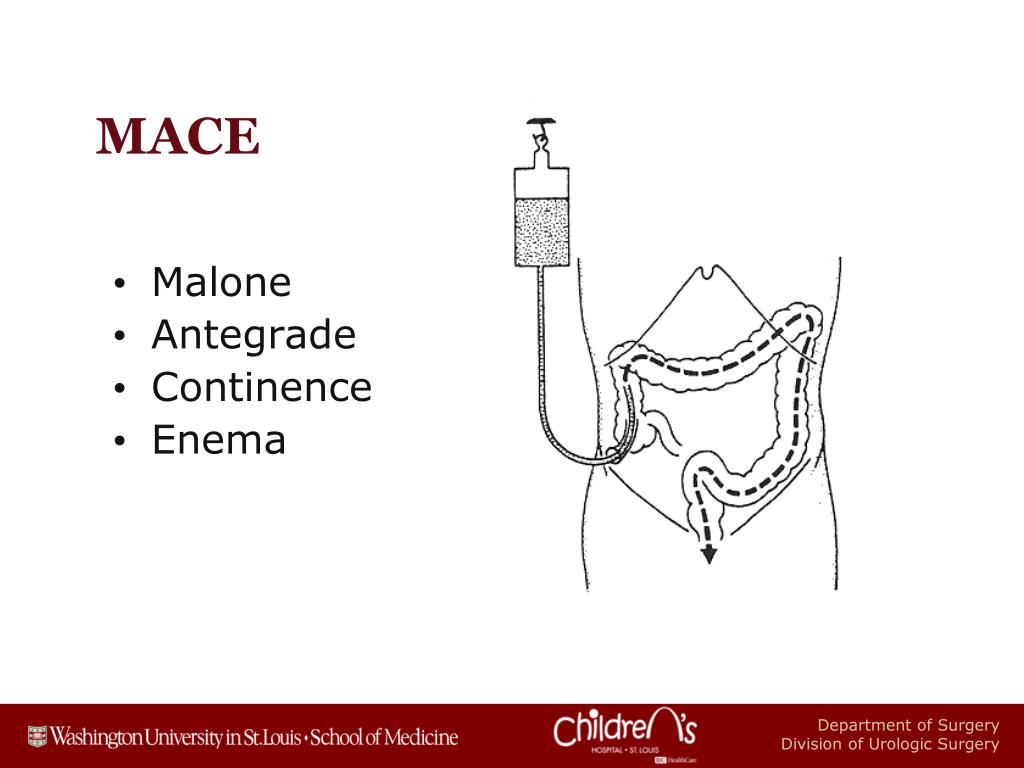 PPT Evaluation, treatment & intervention in the pediatric neuropathic bladder PowerPoint