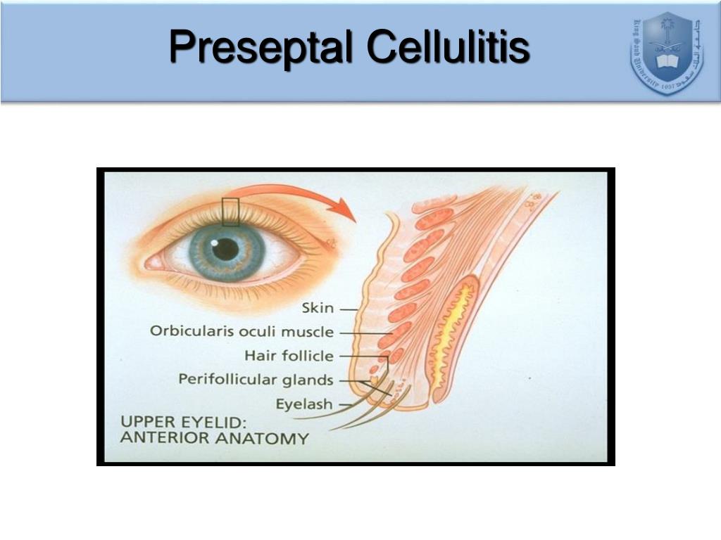 PPT Ocular Emergencies PowerPoint Presentation Free Download ID 