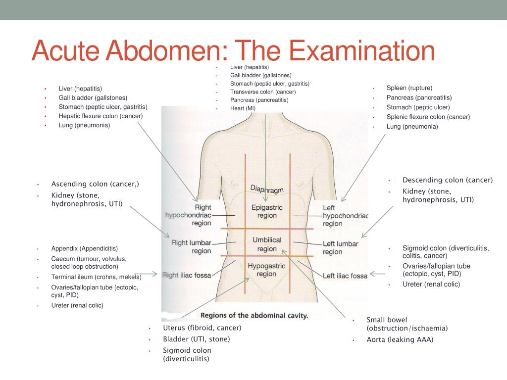 Acute перевод. Протокола acute abdomen. Acute abdominal Pain.