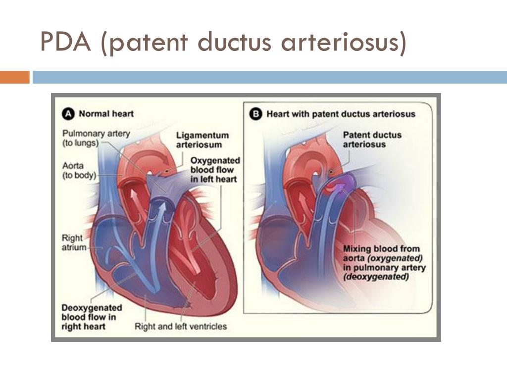 PPT - Congenital Diseases PowerPoint Presentation, free download - ID ...