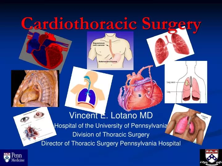 PPT Cardiothoracic Surgery PowerPoint Presentation, free download