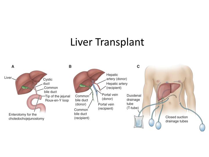 PPT Chapter 39 Assessment and Management of Patients With Hepatic
