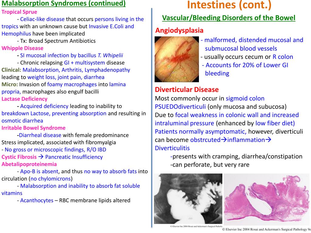 PPT - Gastrointestinal Pathology PowerPoint Presentation - ID:2251116.